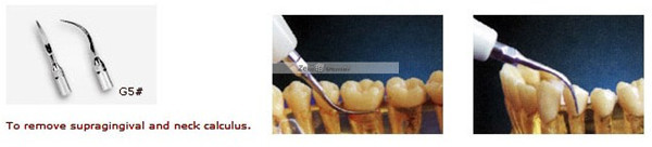 Woodpecker&reg; Scaling Tip G5 compatible EMS & UDS (10 Pcs)